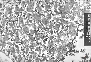 M, 8y. | ceroid-lipofuscinosis - brain M, 8y. | ceroid-lipofuscinosis - brain